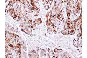 IHC-P Image Immunohistochemical analysis of paraffin-embedded HT29 xenograft , using Cytokeratin 20, antibody at 1:500 dilution. (KRT20 antibody  (C-Term))