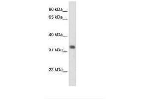 Image no. 1 for anti-3-Hydroxymethyl-3-Methylglutaryl-CoA Lyase (HMGCL) (AA 81-130) antibody (ABIN204975) (HMGCL antibody  (AA 81-130))