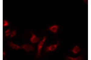 ABIN6274730 staining 293 by IF/ICC. (MRPL14 antibody  (C-Term))
