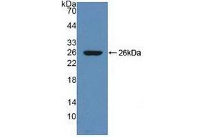 Detection of Recombinant ZPI, Rat using Polyclonal Antibody to Serpin A10 (SERPINA10) (SERPINA10 antibody  (AA 278-425))