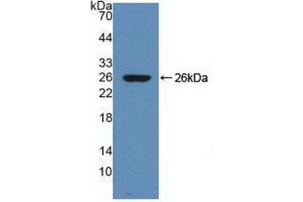 SERPINA10 anticorps  (AA 278-425)