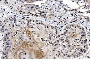 IHC analysis of MAFF using anti-MAFF antibody (ABIN7599317). (MafF antibody  (AA 1-37))