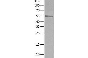 Western Blotting (WB) image for Interferon Regulatory Factor 5 (IRF5) (AA 1-498) protein (His tag) (ABIN7123499) (IRF5 Protein (AA 1-498) (His tag))
