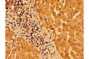 Immunohistochemistry of paraffin-embedded human liver tissue using ABIN7172938 at dilution of 1:100 (TM6SF2 antibody  (AA 290-331))