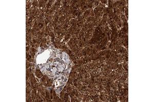 Immunohistochemical staining of human liver with FGFR4 polyclonal antibody  shows strong cytoplasmic positivity in hepatocytes. (FGFR4 antibody)