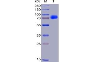 Human CS1, hFc-His Tag on SDS-PAGE under reducing condition. (Catalase Protein (CAT) (Fc Tag,His tag))