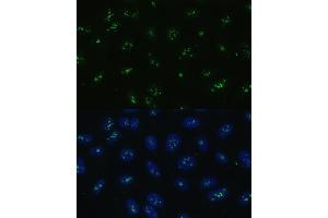 Immunofluorescence analysis of U-2 OS cells using NOLC1 antibody (ABIN6130597, ABIN6144708, ABIN6144709 and ABIN6221608) at dilution of 1:100. (NOLC1 antibody  (AA 400-699))