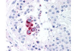 Anti-TBK1 antibody IHC of human testis. (TBK1 antibody  (AA 563-577))