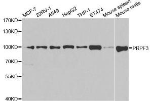 Western Blotting (WB) image for anti-PRP3 Pre-mRNA Processing Factor 3 Homolog (PRPF3) antibody (ABIN1876670)