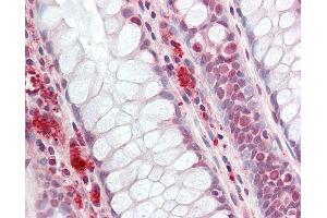 Immunohistochemistry (IHC) image for anti-SWI/SNF Related, Matrix Associated, Actin Dependent Regulator of Chromatin, Subfamily E, Member 1 (SMARCE1) (N-Term) antibody (ABIN6755298)