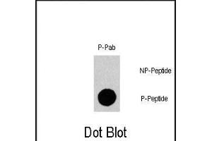 Dot blot analysis of Phospho-Gab1- polyclonal antibody (Cat. (GAB1 antibody  (pTyr659))