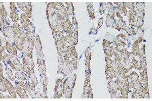 Immunohistochemistry of paraffin-embedded Rat heart using CD59 Polyclonal Antibody at dilution of 1:100 (40x lens). (CD59 antibody)