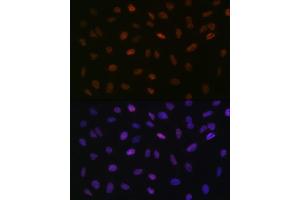 Immunofluorescence analysis of U-2 OS cells using L Rabbit mAb (ABIN7270266) at dilution of 1:100 (40x lens). (ASH2L antibody)