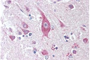 Human Brain, Cortex (formalin-fixed, paraffin-embedded) stained with ICOSLG antibody ABIN294881 at 1:50 followed by biotinylated anti-mouse IgG secondary antibody ABIN481714, alkaline phosphatase-streptavidin and chromogen. (ICOSLG antibody)