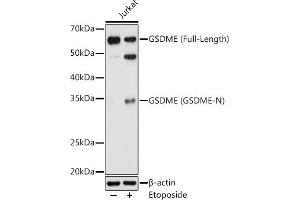 Western blot analysis of extracts of Jurkat cells, using GSDME antibody (ABIN6127757, ABIN6139554, ABIN6139555 and ABIN6223304) at 1:1000 dilution. (Non-Syndromic Hearing Impairment Protein 5 (GSDME) (AA 1-260) antibody)