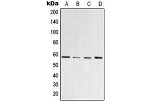 Western blot analysis of PPAR gamma (pS112) expression in HeLa colchicine-treated (A), Raw264. (PPARG antibody  (pSer112))