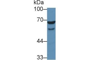 Detection of WASP in Human HL60 cell lysate using Polyclonal Antibody to Wiskott Aldrich Syndrome Protein (WASP) (WASP antibody  (AA 39-251))