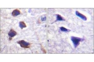 Immunohistochemistry analysis of paraffin-embedded human brain tissue, using Adrenergic Receptor beta2 (Ab-346) Antibody. (beta 2 Adrenergic Receptor antibody  (AA 321-370))