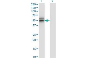 Western Blot analysis of SERPINA12 expression in transfected 293T cell line by SERPINA12 monoclonal antibody (M01), clone 3B3.