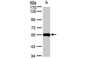 WB Image Sample(30 ug whole cell lysate) A:Hep G2 , 7. (CPM antibody)