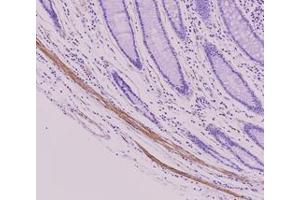 Immunohistochemistry (IHC) image for anti-Tubulin, beta 2B (TUBB2B) antibody (ABIN567611) (TUBB2B antibody)