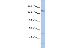 Host:  Rabbit  Target Name:  TDRD9  Sample Type:  ACHN Whole Cell lysates  Antibody Dilution:  1.