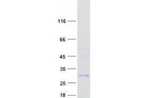 Validation with Western Blot (UBTD1 Protein (Myc-DYKDDDDK Tag))
