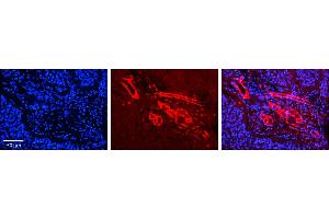 Rabbit Anti-GGPS1 Antibody     Formalin Fixed Paraffin Embedded Tissue: Human Pineal Tissue  Observed Staining: Cytoplasmic in endothelial cells in blood vessels  Primary Antibody Concentration: 1:100  Other Working Concentrations: 1/600  Secondary Antibody: Donkey anti-Rabbit-Cy3  Secondary Antibody Concentration: 1:200  Magnification: 20X  Exposure Time: 0. (GGPS1 antibody  (Middle Region))