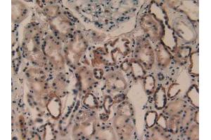 IHC-P analysis of Human Kidney Tissue, with DAB staining. (PLA2G4A antibody  (AA 563-749))