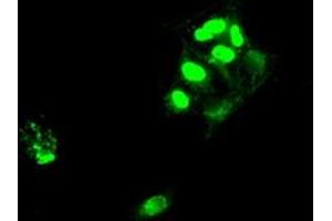 Image no. 2 for anti-SATB Homeobox 1 (SATB1) antibody (ABIN1500811) (SATB1 antibody)