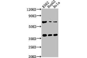 Western Blot Positive WB detected in: K562 whole cell lysate, HepG2 whole cell lysate, Hela whole cell lysate All lanes: CFHR5 antibody at 1:1000 Secondary Goat polyclonal to rabbit IgG at 1/50000 dilution Predicted band size: 65 kDa Observed band size: 65 kDa (CFHR5 antibody  (AA 374-569))