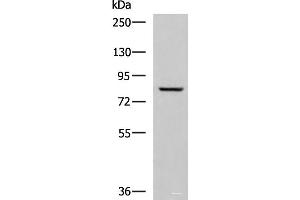 Western blot analysis of Human tongue tissue lysate using TGM3 Polyclonal Antibody at dilution of 1:800 (TGM3 antibody)
