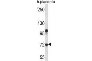 Western Blotting (WB) image for anti-Fibulin 1 (FBLN1) antibody (ABIN2998151)