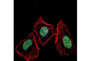 Immunofluorescence (IF) image for anti-X-Ray Repair Complementing Defective Repair in Chinese Hamster Cells 6 (XRCC6) (AA 521-548), (C-Term) antibody (ABIN651280)