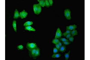 Immunofluorescence (IF) image for anti-Docking Protein 1, 62kDa (Downstream of tyrosine Kinase 1) (DOK1) (AA 1-481) antibody (ABIN7150562)