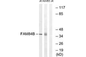 Western blot analysis of extracts from Jurkat/HuvEc cells, using FAM84B Antibody. (FAM84B antibody  (AA 11-60))