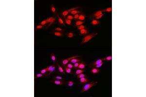 Immunofluorescence analysis of U2OS cells using NFKB1 Rabbit pAb (ABIN6130581, ABIN6144571, ABIN6144573 and ABIN7101802) at dilution of 1:50 (40x lens). (NFKB1 antibody  (AA 740-964))