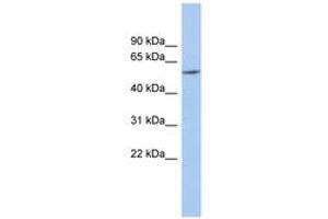 Image no. 1 for anti-Preferentially Expressed Antigen in Melanoma (PRAME) (N-Term) antibody (ABIN6743940) (PRAME antibody  (N-Term))