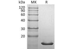 Western Blotting (WB) image for Synuclein, alpha (SNCA) protein (ABIN7320688) (SNCA Protein)