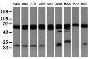 Western blot analysis of extracts (35 µg) from 9 different cell lines by using anti-PUS7 monoclonal antibody. (PUS7 antibody)