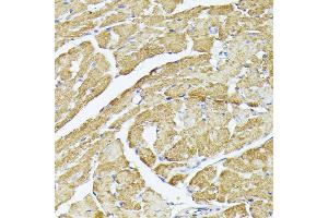 Immunohistochemistry of paraffin-embedded mouse heart using MT-CO3 antibody (ABIN7266636) at dilution of 1:100 (40x lens).