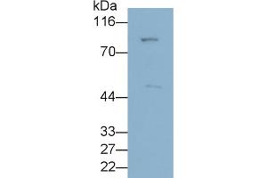 Detection of ANGPTL3 in HepG2 cell lysate using Polyclonal Antibody to Angiopoietin Like Protein 3 (ANGPTL3) (ANGPTL3 antibody  (AA 22-281))