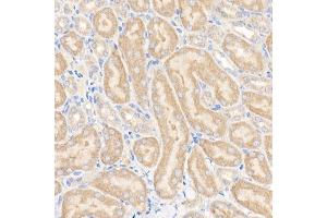Immunohistochemistry of paraffin-embedded mouse kidney using GFPT1 Rabbit mAb (ABIN7267430) at dilution of 1:150 (40x lens). (GFPT1 antibody)