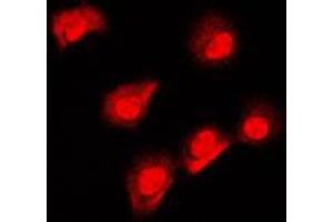 Immunofluorescent analysis of AIFM1 staining in MCF7 cells. (AIF antibody  (N-Term))