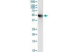 MECP2 MaxPab rabbit polyclonal antibody. (MECP2 antibody  (AA 1-486))