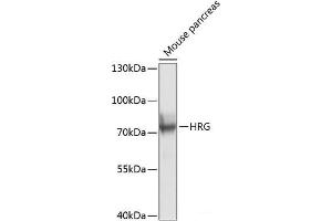 Western blot analysis of extracts of Mouse pancreas using HRG Polyclonal Antibody at dilution of 1:1000. (HRG antibody)