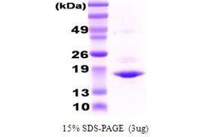 Figure annotation denotes ug of protein loaded and % gel used. (CRYAA Protein)
