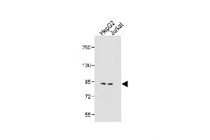 All lanes : Anti-MGAT5 Antibody (C-term) at 1:1000 dilution Lane 1: HepG2 whole cell lysate Lane 2: Jurkat whole cell lysate Lysates/proteins at 20 μg per lane. (MGAT5 antibody  (C-Term))