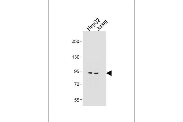 MGAT5 antibody  (C-Term)