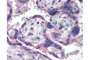 Anti-p73 antibody IHC of human placenta.